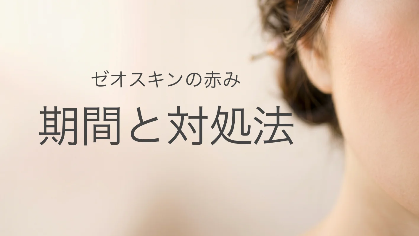 ゼオスキンの赤みはいつまで続くか解説する記事イメージ